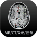 麻花视频免费观看电视剧大全官方版